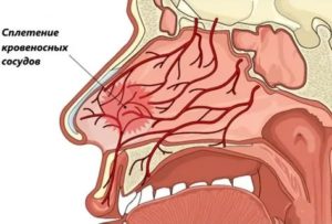 Как укрепить стенки сосудов в носу