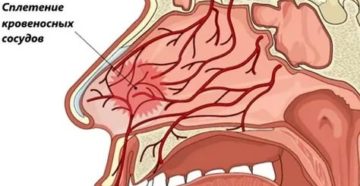 Как укрепить стенки сосудов в носу