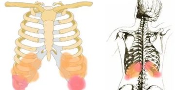 Болит нижнее ребро справа при нажатии