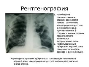 Описание рентгеновских снимков