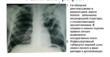 Описание рентгеновских снимков