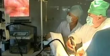 Операция на легких при туберкулезе видео