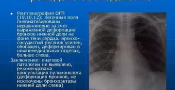 Легочные поля пневматизированы что это значит