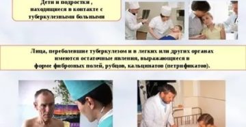 Контакт с туберкулезным больным что делать