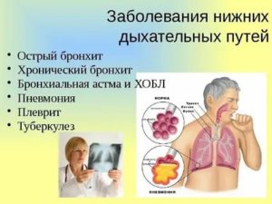 Заболевания нижних дыхательных путей