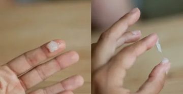 Белые желеобразные выделения