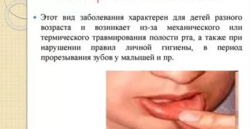 Бактериальный стоматит у детей лечение