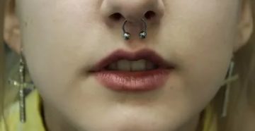 Сколько заживает септум