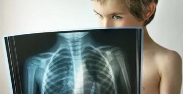 Заболевания легких у детей Заболевания легких у детей