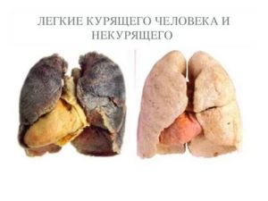 Легкие курящего человека и некурящего