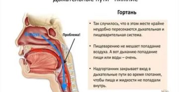 Попадание пищи в дыхательные пути