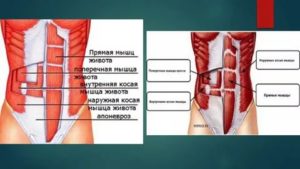 Почему болят мышцы живота без причины