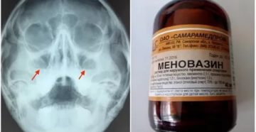 Меновазин при гайморите ребенку