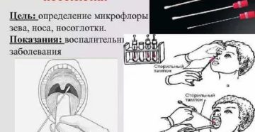 Мазок из зева как подготовиться