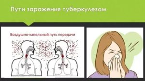 Способы заражения туберкулезом