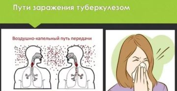 Способы заражения туберкулезом