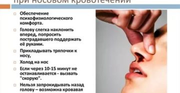 Неотложная доврачебная помощь при носовом кровотечении