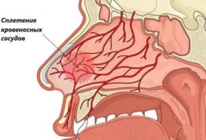 Чем укрепить сосуды в носу