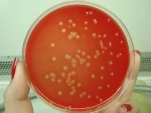 Streptococcus agalactiae лечение
