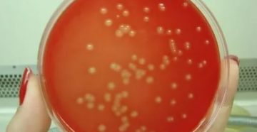 Streptococcus agalactiae лечение