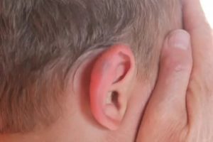 Ушиб уха как лечить