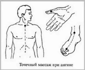 Массаж при тонзиллите