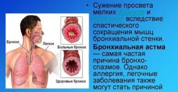 Спазм дыхательных путей причины