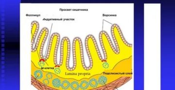 Лимфоидные фолликулы в кишечнике