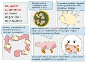 Грибок в крови симптомы лечение