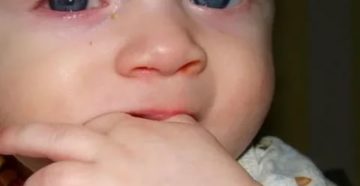 Зеленые сопли и коньюктивит у ребенка