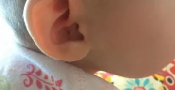 Ребенок 6 месяцев чешет ухо Ребенок 6 месяцев чешет ухо