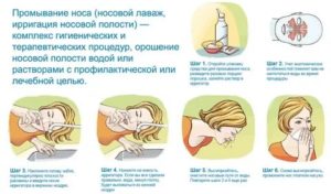 При промывании носа болит голова