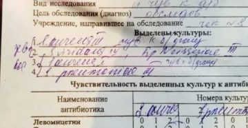 Анализ на дифтерию как сдавать