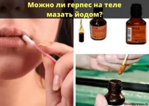 Можно ли мазать простуду йодом