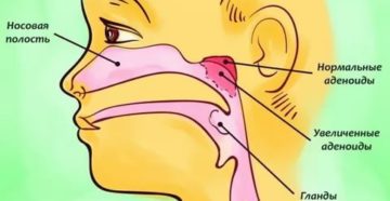 Строение носоглотки у ребенка Строение носоглотки у ребенка