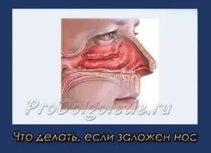 Постоянно не дышит нос что делать