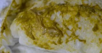 Сопли и понос у ребенка Сопли и понос у ребенка