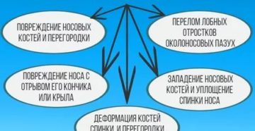 Головная боль и кровь из носа причины