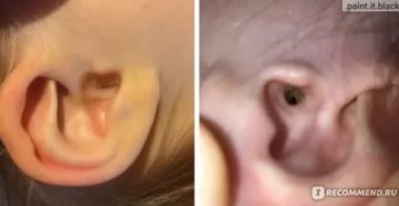 Как выглядит ушная пробка у детей фото Как выглядит ушная пробка у детей фото