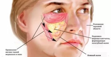 Почему болят скулы на лице