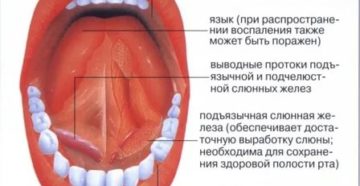 Воспалилась слизистая во рту лечение