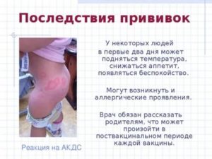 Прививка от полиомиелита можно ли купаться