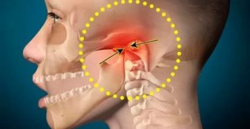 Почему болит скула с правой стороны