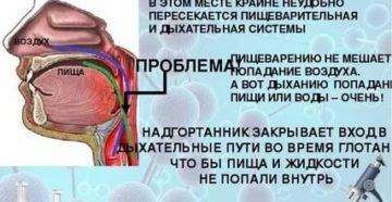 Пища попала в дыхательные пути что делать