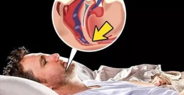 Во сне тяжело дышать