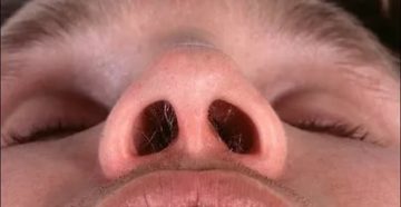 Жжение в одной ноздре