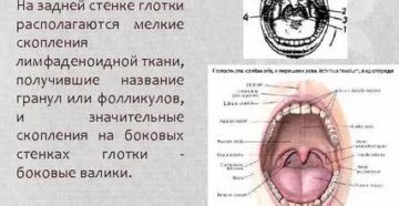 Лимфоидные фолликулы в горле фото