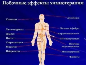 Побочные эффекты химиотерапии в онкологии