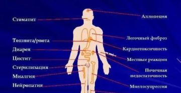 Побочные эффекты химиотерапии в онкологии