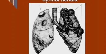 Пузырек в легких